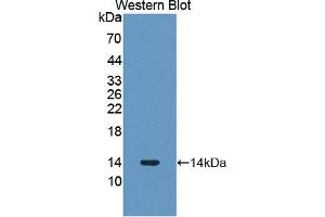 Detection of Recombinant PLOD3, Human using Polyclonal Antibody to Procollagen Lysine-2-Oxoglutarate-5-Dioxygenase 3 (PLOD3)