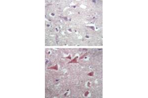 Immunohistochemical analysis of TUBB2A in paraffin-embedded formalin-fixed human brain tissue using an isotype control (top) and TUBB2A polyclonal antibody  (bottom) at 5 ug/mL . (TUBB2A anticorps  (AA 417-435))