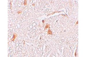 Immunohistochemical staining of human brain cells with LOC729993 polyclonal antibody  at 2. (Shisa9 anticorps  (Internal Region))