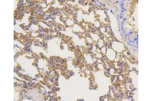 Immunohistochemistry of paraffin-embedded mouse lung using ARRB1 antibody (ABIN5996907) at dilution of 1/100 (40x lens). (beta Arrestin 1 anticorps)