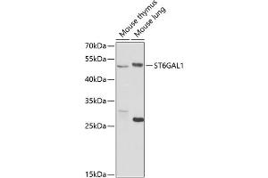 Western blot analysis of extracts of various cell lines, using ST6G antibody (ABIN6130083, ABIN6148536, ABIN6148538 and ABIN6221427) at 1:1000 dilution. (ST6GAL1 anticorps  (AA 27-200))