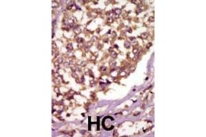 anti-BMX Non-Receptor Tyrosine Kinase (BMX) (AA 212-242) antibody