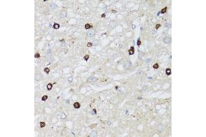 Immunohistochemistry of paraffin-embedded rat brain using MIP antibody (ABIN5971491) at dilution of 1/100 (40x lens). (MIP anticorps)