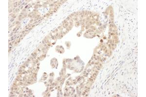 anti-Proteasome (Prosome, Macropain) 26S Subunit, ATPase, 4 (PSMC4) (AA 1-50) antibody