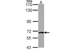 WB Image Sample (30 ug of whole cell lysate) A: JurKat 7. (Phosphoglucomutase 3 anticorps)