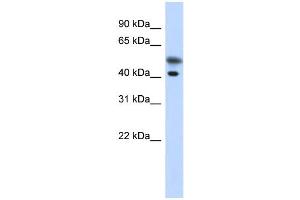 WB Suggested Anti-TMOD2 Antibody Titration: 0. (TMOD2 anticorps  (N-Term))