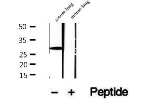 Western blot analysis of extracts of mouse lung tissue, using DIO1 antibody.