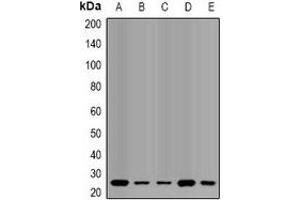 Western blot analysis of QDPR expression in HL60 (A), SW620 (B), mouse liver (C), mouse brain (D), rat liver (E) whole cell lysates. (QDPR anticorps)