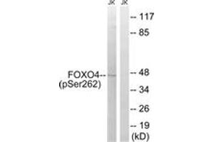 Western blot analysis of extracts from Jurkat cells treated with starved 24h, using FOXO4 (Phospho-Ser262) Antibody. (FOXO4 anticorps  (pSer262))