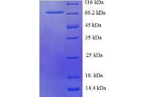 SDS-PAGE (SDS) image for Histidyl-tRNA Synthetase 2, Mitochondrial (Putative) (HARS2) (AA 34-506) protein (His-SUMO Tag) (ABIN5709641)