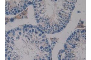 Detection of PAOX in Mouse Testis Tissue using Polyclonal Antibody to Polyamine Oxidase (PAOX)