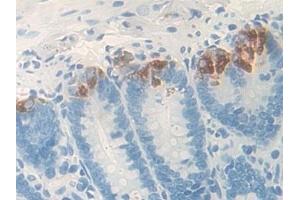 Detection of GIF in Rat Small intestine Tissue using Polyclonal Antibody to Gastric Intrinsic Factor (GIF)