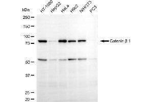 Western blotting analysis using catenin beta 1 antibody (ABIN7797929).