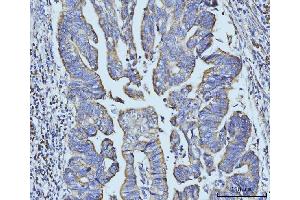 IHC analysis of BZW2 using anti-BZW2 antibody (ABIN7600608).