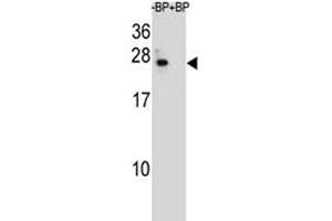 BCL-2 antibody pre-incubated without (Lane 1) and with (2) blocking peptide in 293 lysate (Bcl-2 anticorps  (AA 87-116))