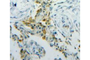 Used in DAB staining on fromalin fixed paraffin-embedded lung tissue (FABP5 anticorps  (AA 1-135))