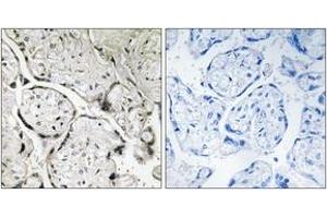 Immunohistochemistry analysis of paraffin-embedded human placenta tissue, using SAR1B Antibody.