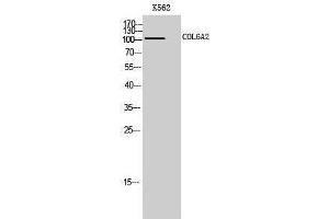 Western Blotting (WB) image for anti-Collagen, Type VI, alpha 2 (COL6A2) (Internal Region) antibody (ABIN3184023) (COL6A2 anticorps  (Internal Region))
