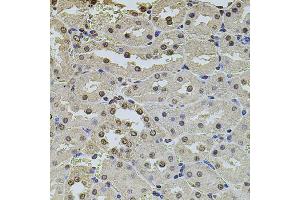 Immunohistochemistry of paraffin-embedded rat kidney using POT1 antibody (ABIN2650945) at dilution of 1:100 (40x lens). (POT1 anticorps)