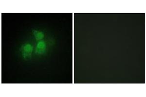 Immunofluorescence analysis of HepG2 cells, using IPPK antibody. (IPPK anticorps  (N-Term))