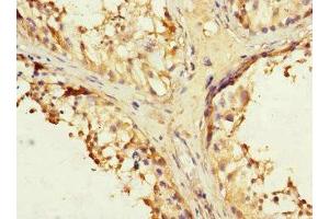 Immunohistochemistry analysis of paraffin-embedded human testis tissue using IFNLR1 antibody at a dilution of 1/100. (IL28RA anticorps  (AA 21-228))