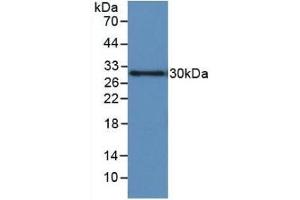 Detection of Recombinant IGFBP1, Human using Monoclonal Antibody to Insulin Like Growth Factor Binding Protein 1 (IGFBP1) (IGFBPI anticorps  (AA 36-235))