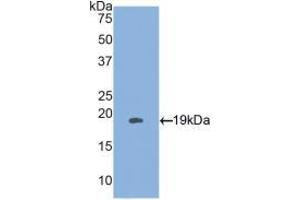 Western blot analysis of recombinant Human HSPb3. (HSPB3 anticorps  (AA 1-150))
