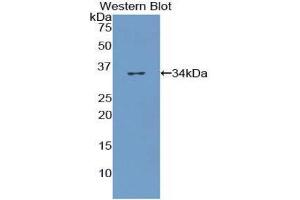 Western Blotting (WB) image for anti-Collagen, Type VII (COL7) (AA 190-472) antibody (ABIN1175574) (COL7 anticorps  (AA 190-472))