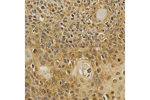 Immunohistochemistry (IHC) image for anti-Nuclear Factor of Activated T-Cells, Cytoplasmic, Calcineurin-Dependent 1 (NFATC1) (AA 20-300) antibody (ABIN3022101)