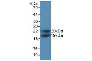 Detection of Recombinant CDKN1A, Human using Polyclonal Antibody to Cyclin Dependent Kinase Inhibitor 1A (CDKN1A) (p21 anticorps  (AA 1-164))