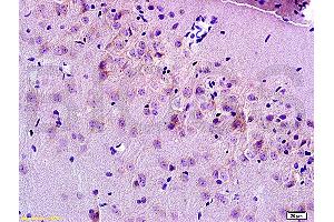Formalin-fixed and paraffin embedded rat brain tissue labeled Anti-MRP1 Polyclonal Antibody, Unconjugated (ABIN671526) at 1:200, followed by conjugation to the secondary antibody and DAB staining