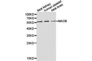 Western Blotting (WB) image for anti-Monoamine Oxidase B (MAOB) antibody (ABIN1873594) (Monoamine Oxidase B anticorps)