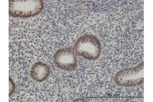 Immunoperoxidase of monoclonal antibody to RNPC2 on formalin-fixed paraffin-embedded human endometrium.