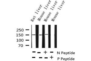 Western blot analysis of Phospho-EGFR (Ser1071) expression in various lysates (EGFR anticorps  (pSer1071))