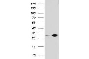 Western Blotting (WB) image for anti-Sepiapterin Reductase (SPR) antibody (ABIN1501114) (SPR anticorps)