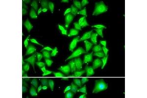 Immunofluorescence analysis of HeLa cells using PPM1A Polyclonal Antibody (PPM1A anticorps)