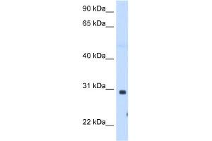 WB Suggested Anti-ST3GAL3 Antibody Titration:  1.