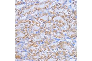 Immunohistochemistry of paraffin-embedded mouse kidney using NME6 antibody (ABIN7268942) at dilution of 1:100 (40x lens).