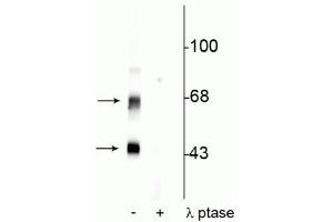 Western blot of rat brain lysate showing specific immunolabeling of the ~50 kDa α- and the ~60 kDa β-CaM Kinase II phosphorylated at Thr306 in the first lane (-). (CaMKII alpha/beta (pThr306) anticorps)