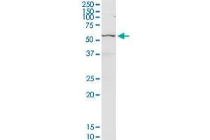 CHEK2 MaxPab rabbit polyclonal antibody. (CHEK2 anticorps  (AA 1-543))