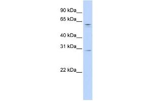 Western Blotting (WB) image for anti-REC8 Homolog (Yeast) (REC8) antibody (ABIN2459159) (REC8 anticorps)