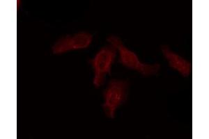 ABIN6274488 staining COLO205 by IF/ICC. (ATF6B anticorps  (Internal Region))