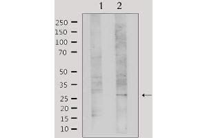 Western blot analysis of extracts from Hela, using Galectin 3 Antibody. (Galectin 3 anticorps  (Internal Region))