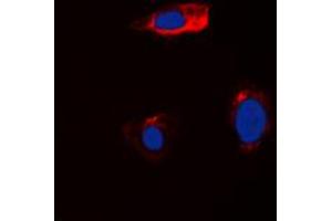 Immunofluorescent analysis of Cystatin 11 staining in HEK293T cells.