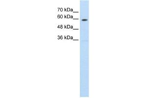 WB Suggested Anti-SLC11A1 Antibody Titration:  1.