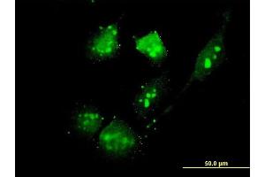 Immunofluorescence of monoclonal antibody to THG-1 on HeLa cell.
