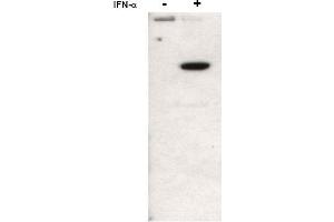 Image no. 1 for anti-Signal Transducer and Activator of Transcription 2, 113kDa (STAT2) (N-Term), (pTyr690) antibody (ABIN401443) (STAT2 anticorps  (N-Term, pTyr690))