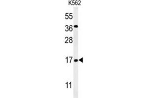 Western Blotting (WB) image for anti-N(alpha)-Acetyltransferase 50, NatE Catalytic Subunit (NAA50) antibody (ABIN3002220) (NAA50 anticorps)