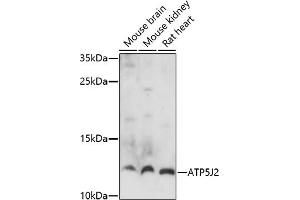 Western blot analysis of extracts of various cell lines, using J2 antibody (ABIN7265725) at 1:1000 dilution.