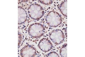 (ABIN6242630 and ABIN6577239) staining SD1 in hun colon tissue sections by Immunohistochemistry (IHC-P - paraforldehyde-fixed, paraffin-embedded sections).